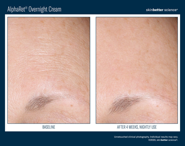 Intensive AlphaRet Overnight Cream