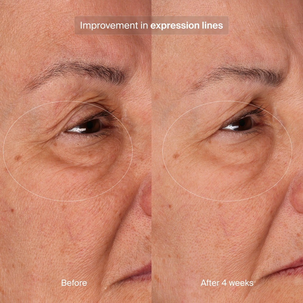 Bioadaptive Stress Repair