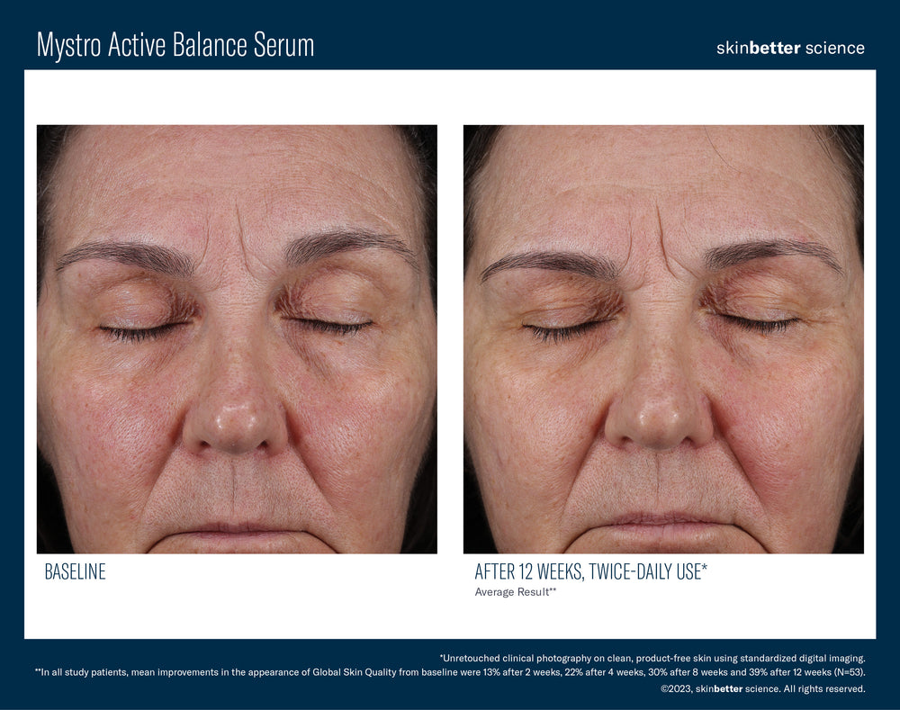 Mystro Active Balance Serum