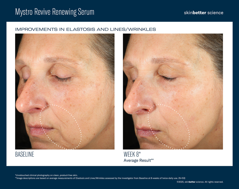 Mystro Revive Renewing Serum