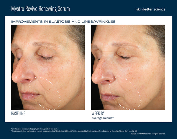Mystro Revive Renewing Serum