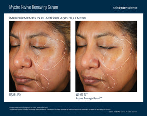 Mystro Revive Renewing Serum