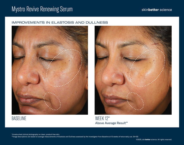 Mystro Revive Renewing Serum